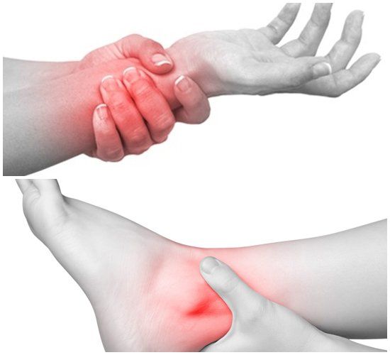 Viêm bao hoạt dịch khớp: Những điều cần biết