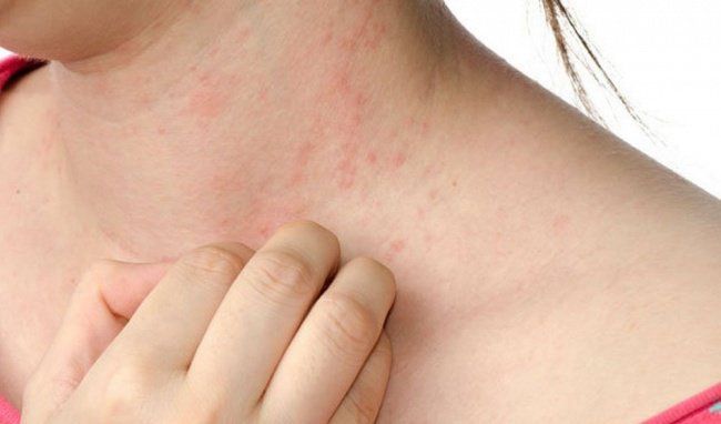 Thuốc gastropulgite là thuốc gì: Công dụng và liều dùng