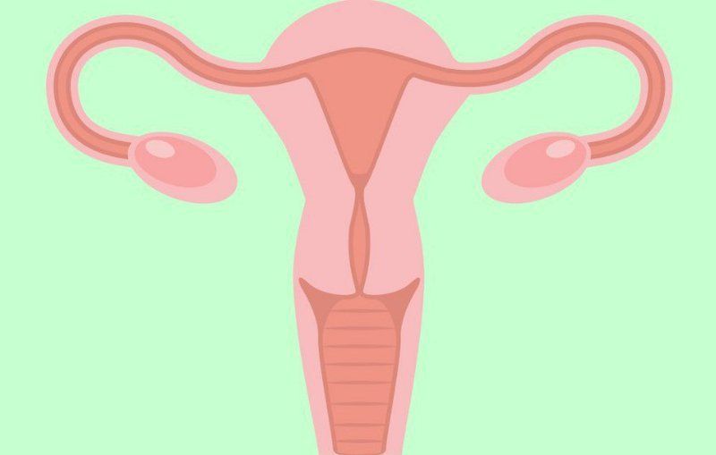 Tắc ống dẫn trứng: Nguyên nhân gây vô sinh