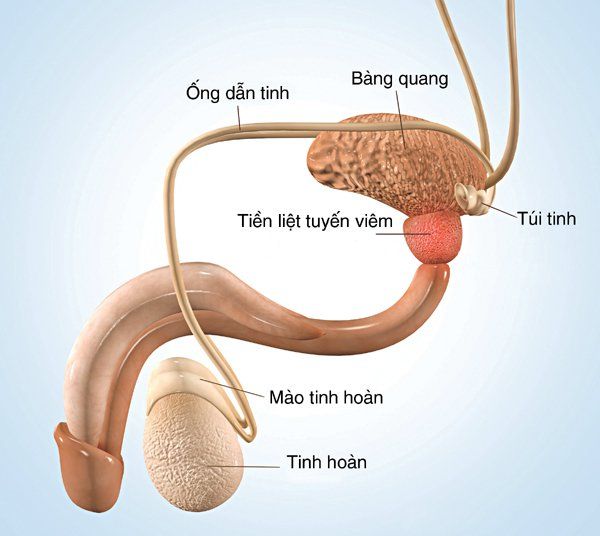 Tại sao nước tiểu của bạn màu nâu?