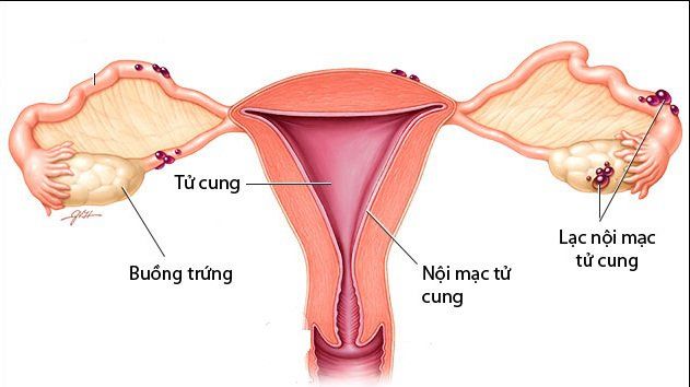 Các biểu hiện có thể gặp sau khi uống thuốc tránh thai khẩn cấp