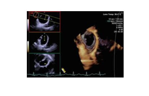 Các kiểu siêu âm tim