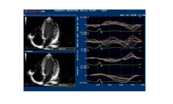 Các kiểu siêu âm tim