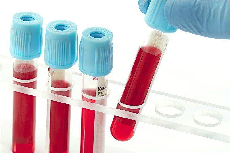 Xét nghiệm HBeAg trong chẩn đoán viêm gan B
