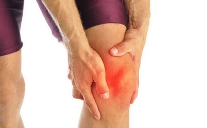 Tiêu chuẩn chẩn đoán thoái hóa khớp gối
