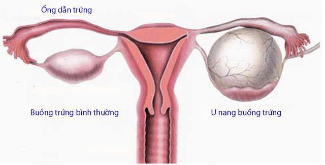 Tổng quan về buồng trứng