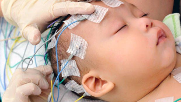 Phần 1: Đánh giá nguyên nhân động kinh từ các xét nghiệm thường quy đến xét nghiệm gen