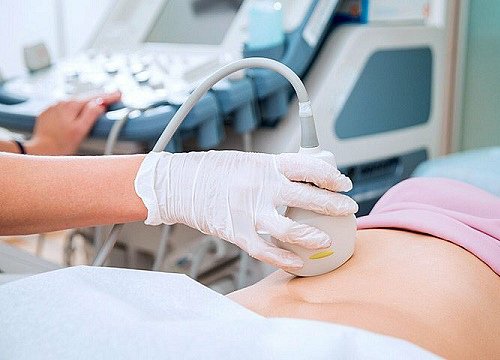 Theo dõi nang noãn khi thực hiện IVF