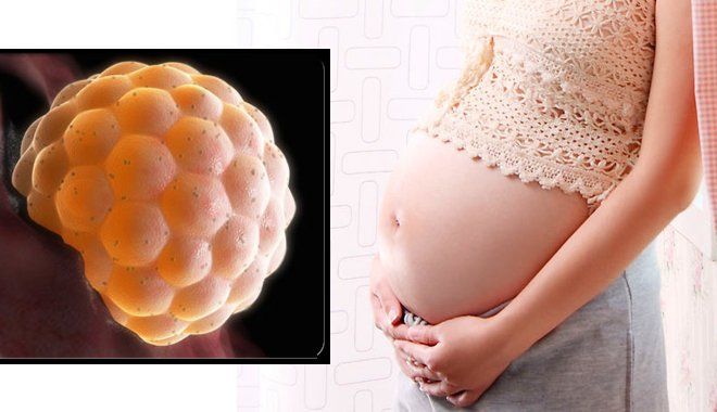 Cắt tử cung ở bệnh nhân bị thai trứng (chửa trứng)