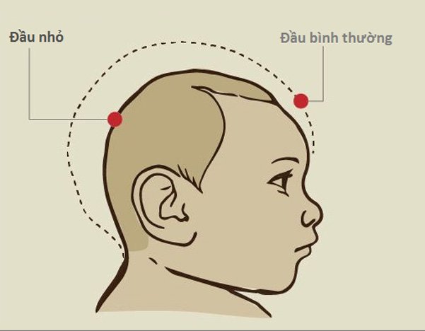 Di chứng của trẻ bị ngạt có thể ảnh hưởng đến chức năng nào của cơ thể?
