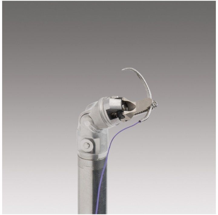 Sỏi ống mật chủ: Nguyên nhân, triệu chứng, biến chứng và cách điều trị