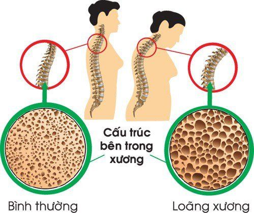 Tổng quan về buồng trứng