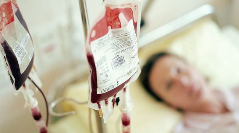 Tại sao hồng cầu rửa không bị lẫn huyết tương, bạch cầu và tiểu cầu trong quá trình xử lý?
