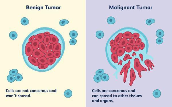 Liquid Biopsy - Sinh thiết lỏng trong chẩn đoán và tầm soát ung thư: những hứa hẹn và thách thức