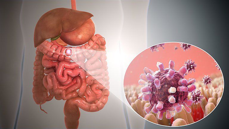 Bạch cầu ái toan và viêm dạ dày ruột do bạch cầu ái toan
