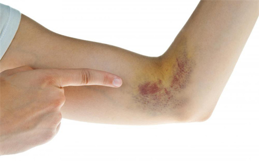 Các dấu hiệu và triệu chứng cảnh báo 'sức khỏe' lá gan