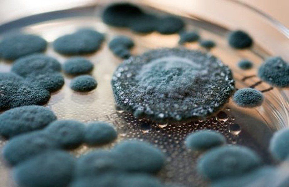 Bệnh viêm phổi quá mẫn là gì? Có nguy hiểm không?