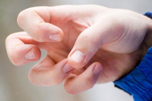 Phần 3: Đánh giá động kinh