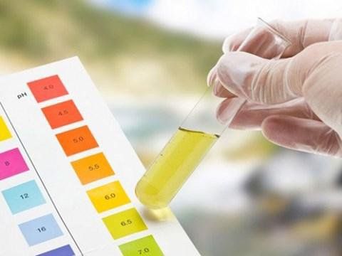 Các xét nghiệm trong Lab dùng để chẩn đoán Lupus