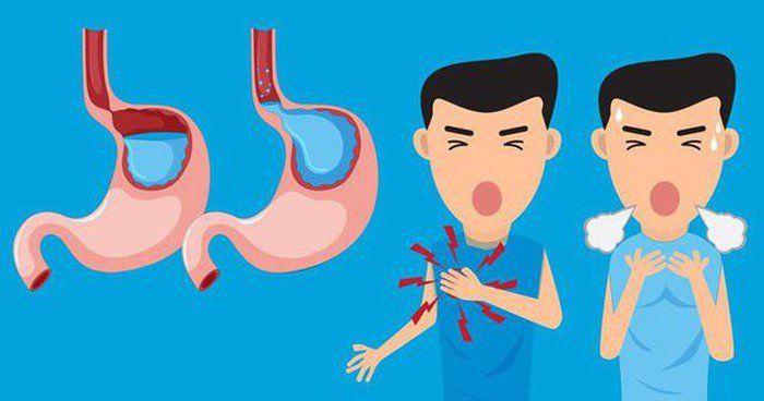 Vì sao trào ngược dạ dày thực quản lại gây ho nhiều?