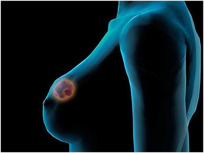 Tại sao phải bổ sung axit folic cho mẹ bầu? Liều lượng sử dụng