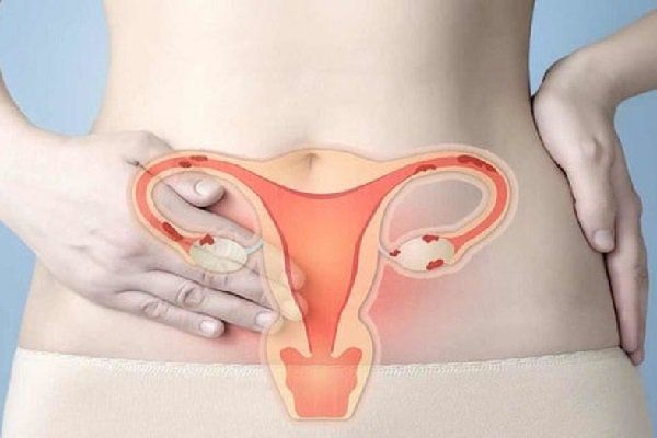 Virus gây ung thư cổ tử cung có lây không?