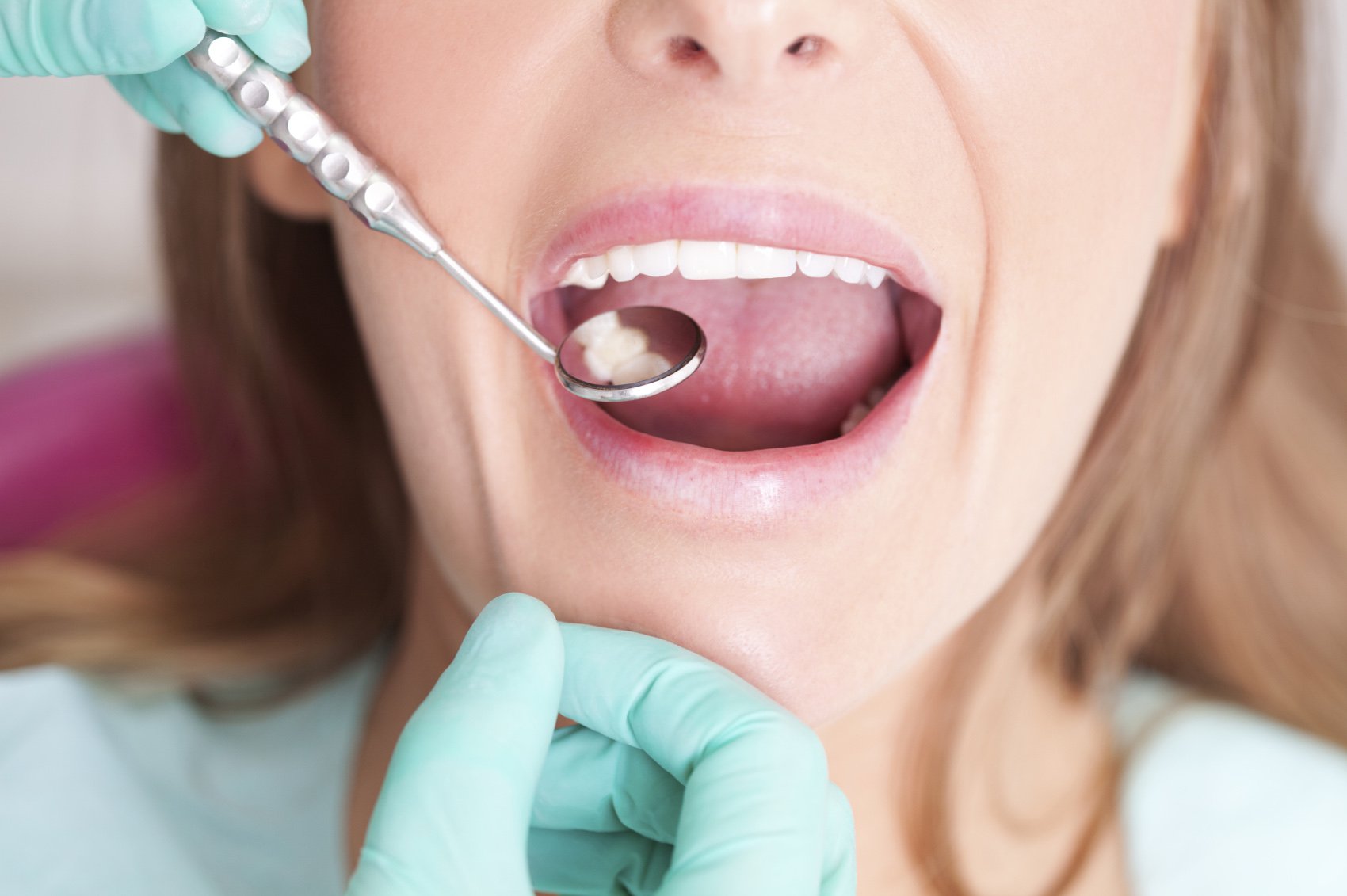  Tháo răng sứ làm lại trong các trường hợp nào? 