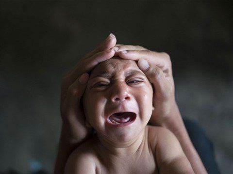 Chu vi vòng đầu thai nhi theo từng tuần thai