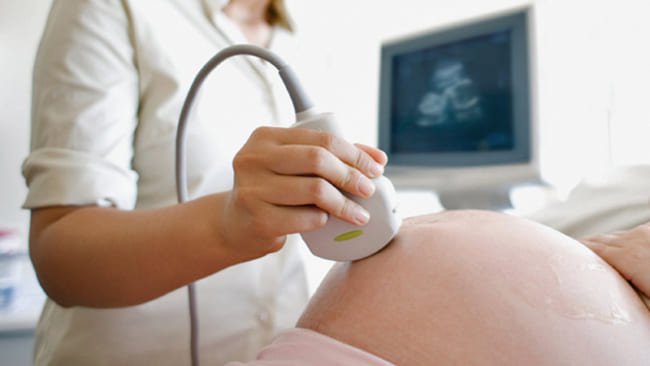 Giãn bể lớn hố sau ở thai nhi