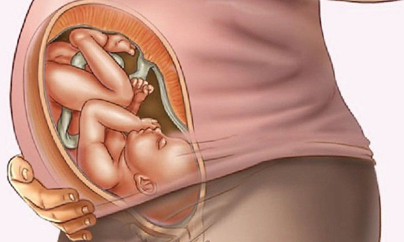 Sa dây rốn: Biến chứng nguy hiểm với thai nhi