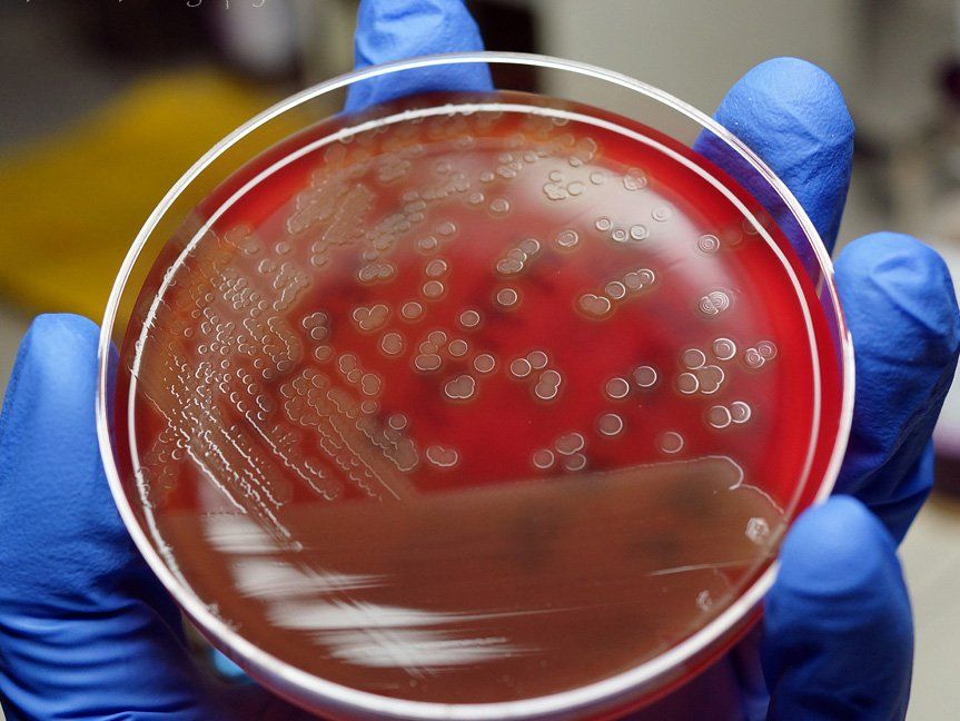 Xác định loại vi khuẩn bằng phương pháp nhuộm gram