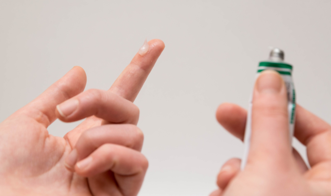 Mụn cóc dưới bàn chân có nguy hiểm?