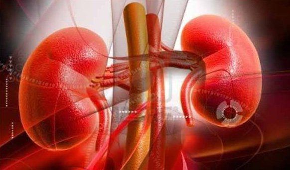 Viêm cầu thận lupus: Những điều cần biết