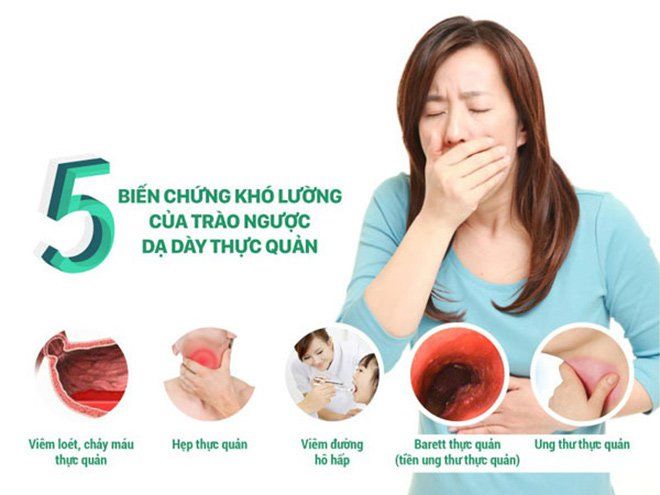 Vì sao trào ngược dạ dày thực quản lại gây ho nhiều?