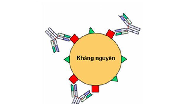 Các xét nghiệm chẩn đoán bệnh tự miễn