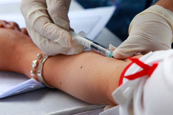 Cách đọc kết quả xét nghiệm HbA1C