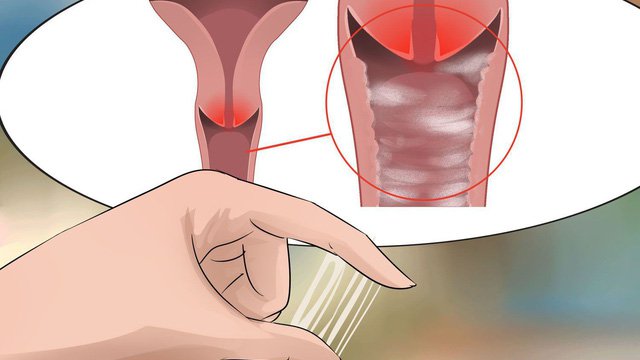 Cách đọc kết quả xét nghiệm nhuộm soi dịch sinh dục