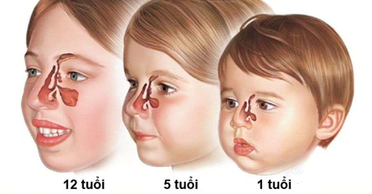 9 bệnh phổ biến do virus hoặc vi khuẩn gây nên