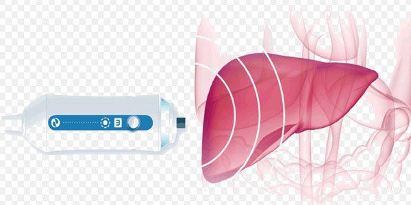 Siêu âm gan có khối giảm âm phản ánh điều gì?