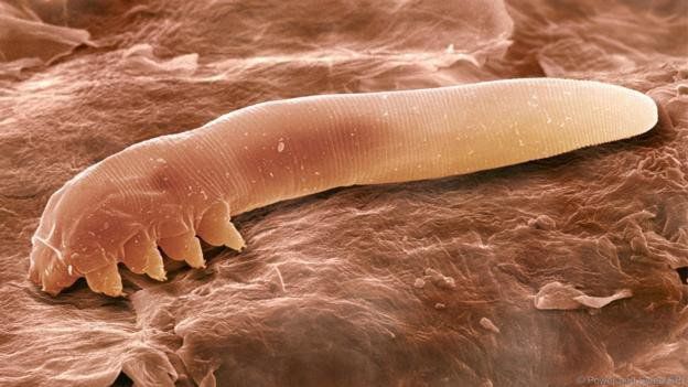 Tìm hiểu bệnh viêm da do Demodex