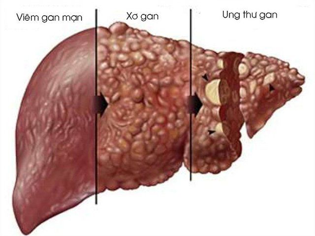 Ý nghĩa chụp cộng hưởng từ toàn thân