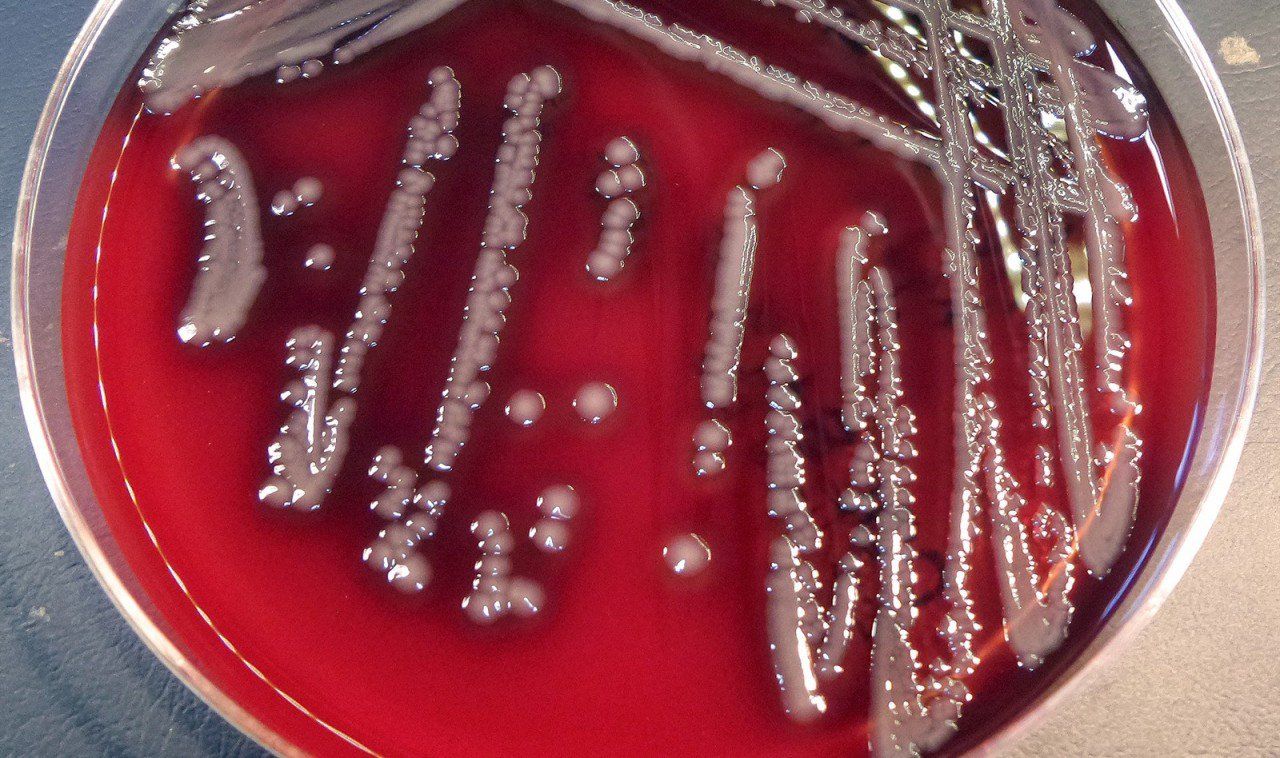 Aeromonas hydrophila có phải vi khuẩn ăn thịt người?