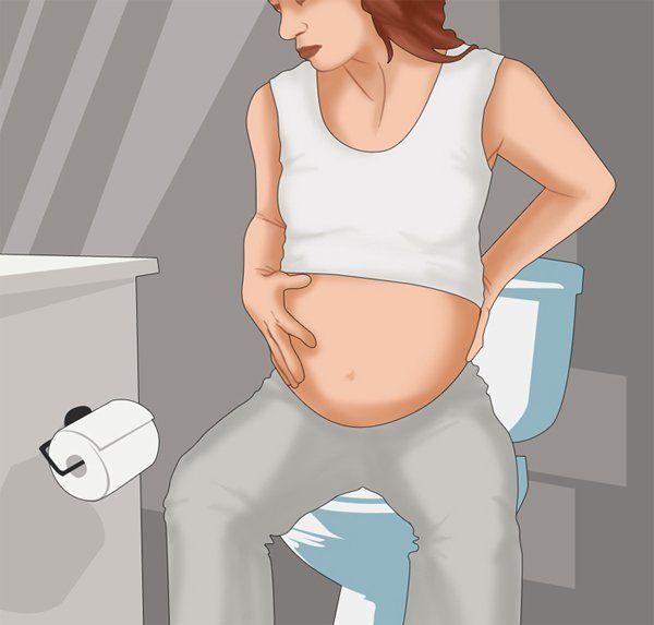 Lưu ý trong chẩn đoán viêm ruột thừa ở bà bầu