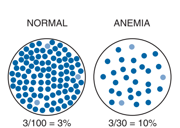 Thông tin cần biết về xét nghiệm hồng cầu lưới