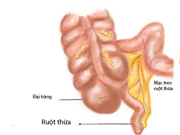 Mạc treo là gì?