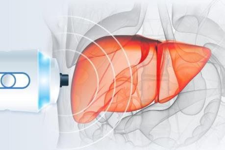Các chỉ định của FibroScan đo độ đàn hồi và độ nhiễm mỡ của gan