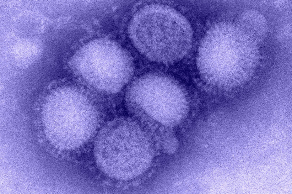 Thời gian ủ bệnh của virus cúm A/H1N1?