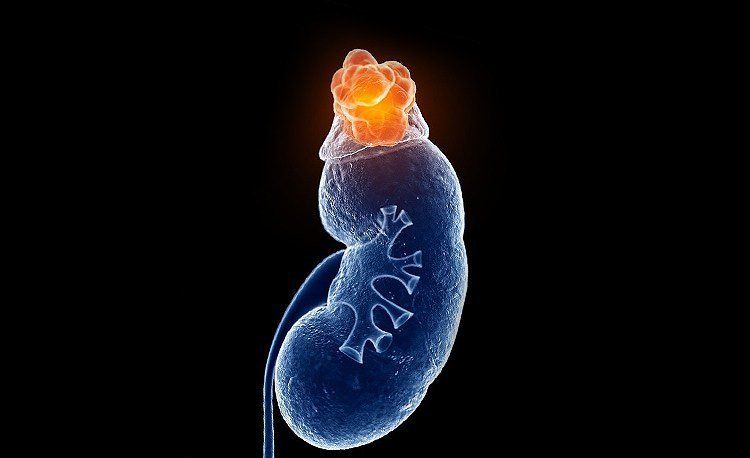 Cảnh giác với thuốc nhỏ/xịt mũi có chứa corticoid (corticosteroid/steroid)