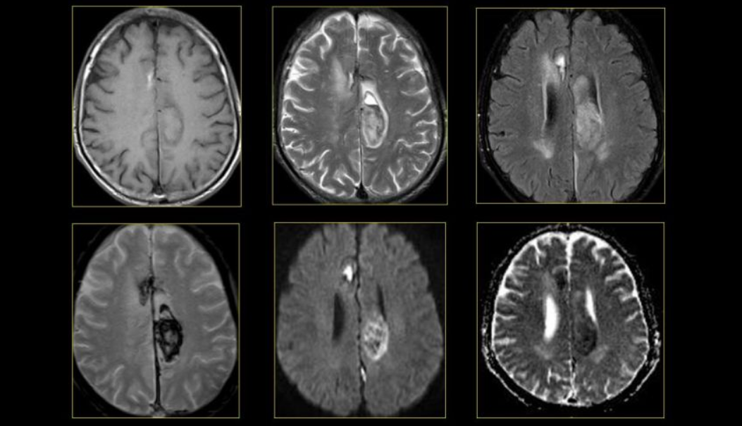 Ứng dụng của MRI trong tim mạch, não, tủy sống, xương, nội tạng