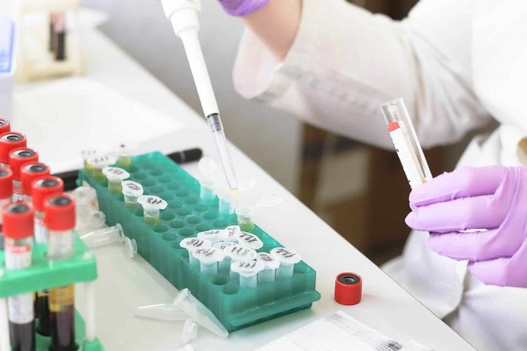Vì sao bạn bị đau thần kinh sau zona?